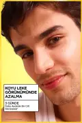 سرم صورت ویتامین C+ فوق درخشان 30ML (نیاسینامید، اسید سالیسیلیک، ملسیل) سرم روشن کننده