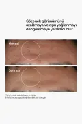 سرم ضد لک و کاهش ظاهر منافذ 30ml با نیاسینامید 10% و زینک 1%