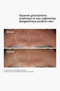سرم ضد لک و کاهش ظاهر منافذ 30ml با نیاسینامید 10% و زینک 1%