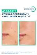 کرم مرطوب کننده ضد جوش و لک آکنه حاوی اسید سالیسیلیک سبیوم کراتو+ 30ml