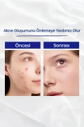کرم رتینول ویتامین A ضد پیری و چین و چروک 50 گرم
