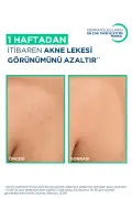 اسپری بدن سبیوم کراتو+ ضد جوش و لک آکنه حاوی اسید سالیسیلیک و نیاسینامید 150ml
