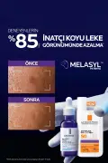 کرم ضد آفتاب آنتلیوس اوومون با محافظت بالا SPF50+ برای پوست‌های لک‌دار 50ml