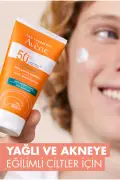 کرم ضد آفتاب با SPF 50+ برای پوست‌های چرب و مستعد آکنه 50 میلی‌لیتر
