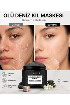 ماسک صورت خاک رس دریای مرده با کلاژن ضد جوش‌های سرسیاه و پاک‌کننده پوست مرده 150 گرم