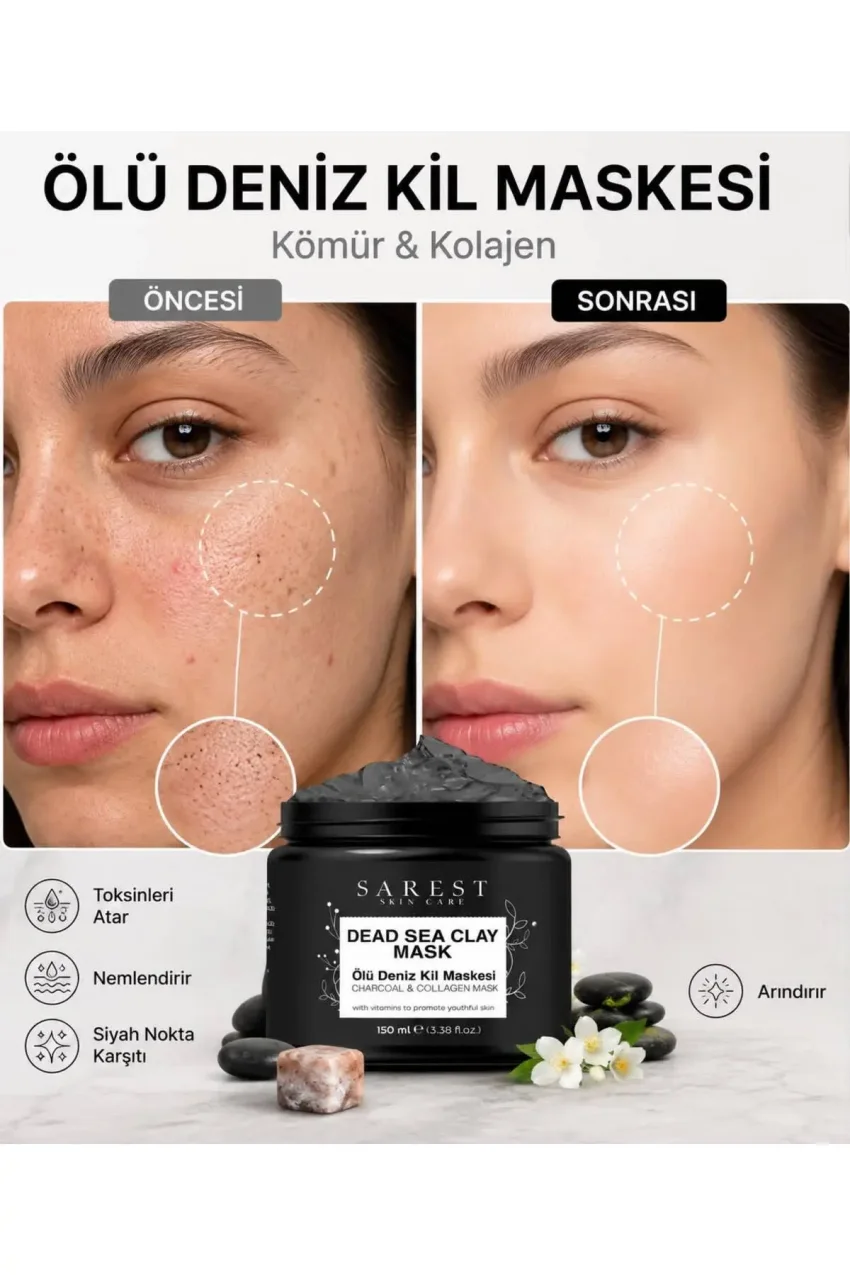 ماسک صورت خاک رس دریای مرده با کلاژن ضد جوش‌های سرسیاه و پاک‌کننده پوست مرده 150 گرم